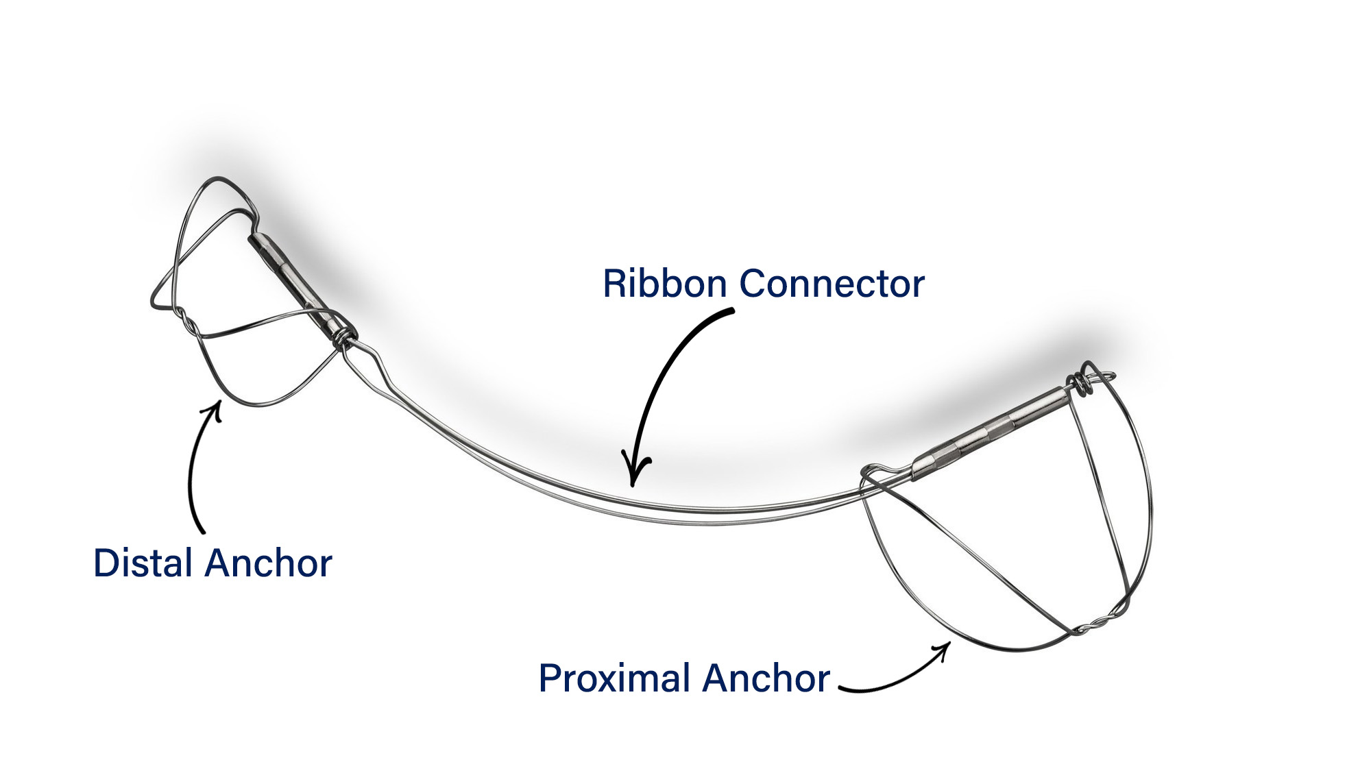 Carillon Mitral Contour System: distal anchor, ribbon connector, proximal anchor